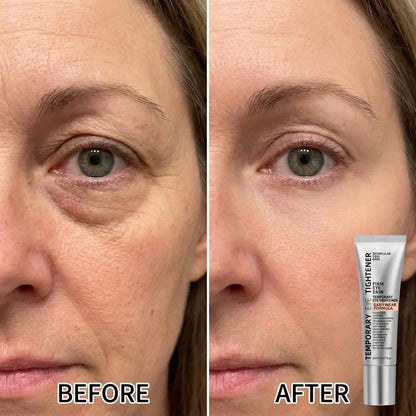 Eye Tightening Serum